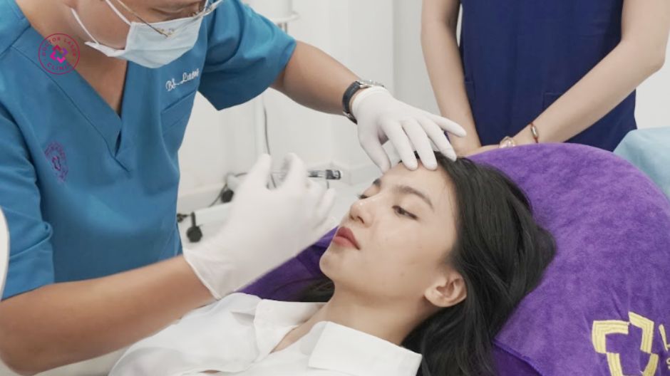 tiêm filler cải thiện thâm mắt bẩm sinh
