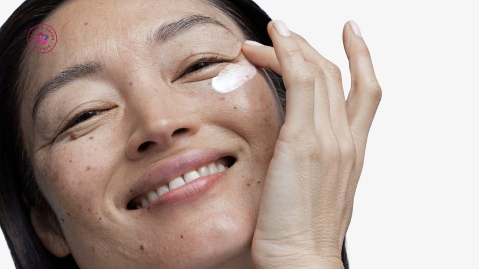 tiếp xúc mỹ phẩm làm tàn nhang rõ hơn